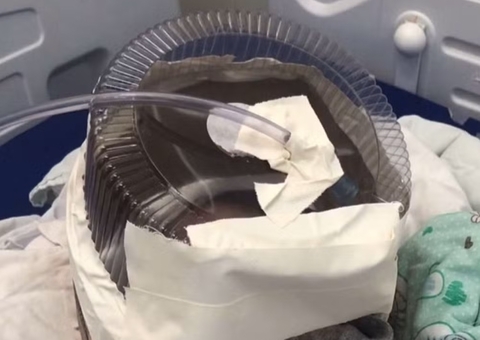 Hospital usa embalagem de bolo para improvisar máscara de oxigênio em bebê