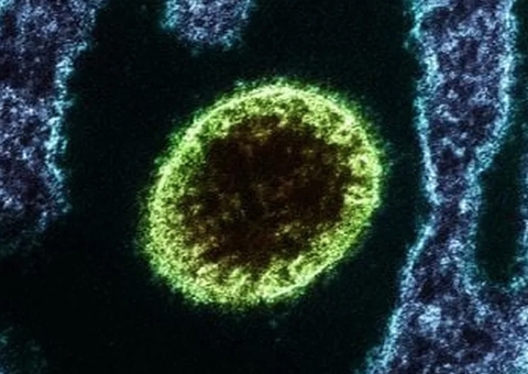 Entenda o que é Nipah vírus, doença que acendeu alerta após morte de adolescente na Índia