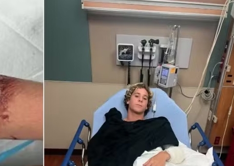 Surfista da seleção sub-16 dos EUA quase tem braço arrancado por tubarão