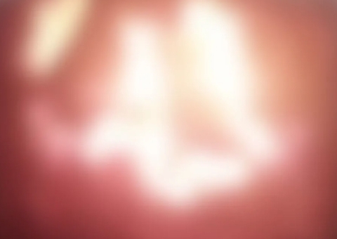 Adolescente queima 5 cães em fornalha, grava vídeo de animais gritando e manda para amigos