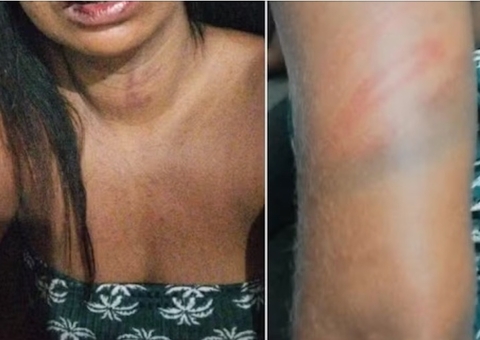 Mulher é espancada por atrasar 12 minutos ao pegar namorado no trabalho