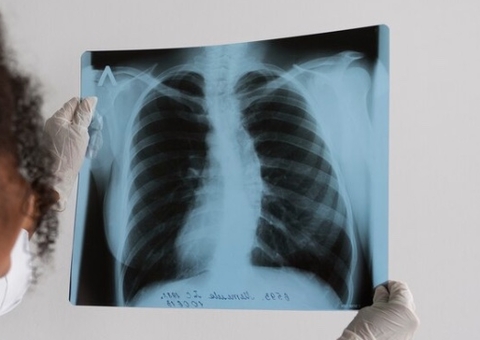 Mulher é forçada a ficar nua para fazer raio-x; técnico ofereceu dinheiro para não expor o caso