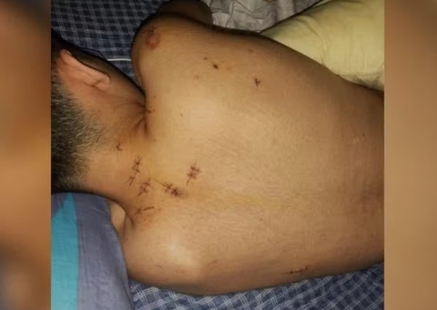 Adolescente é esfaqueado 15 vezes enquanto dormia e obrigado a fazer Pix para assaltante