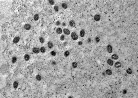 OMS convoca reunião para reavaliar emergência em Mpox     