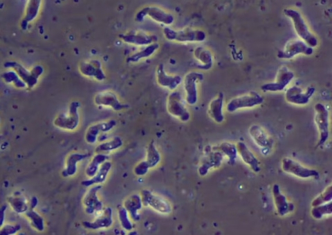 Morte de bebê é investigada após suspeita de infecção por ameba super-rara no Brasil