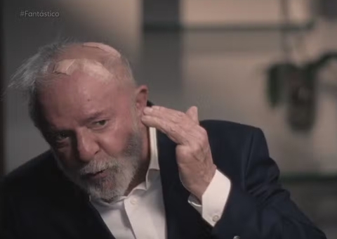 Presidente Lula exibe curativos e relata furos na cabeça após cirurgia 
