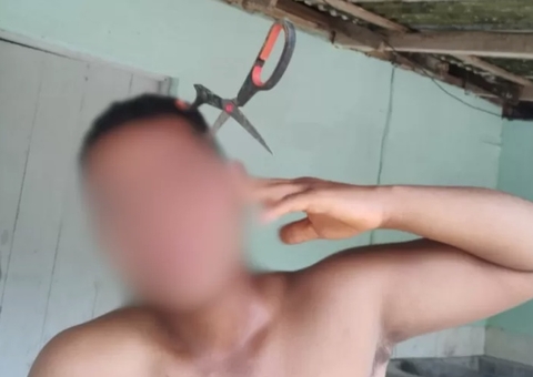 Homem fica com tesoura cravada na cabeça após tentar separar briga