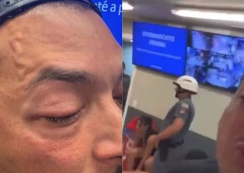 Deputado defensor da PM acusa policiais de agredi-lo em show em SP