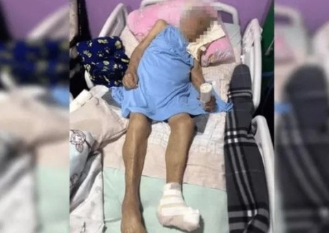 Idosa de 103 anos tem pé amputado sem anestesia em cirurgia em casa