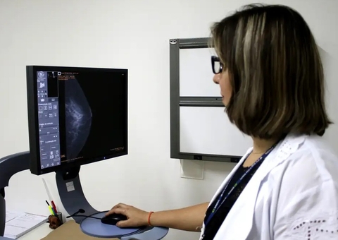 Médicos pedem ampliação da faixa etária para mamografia de rastreio do câncer