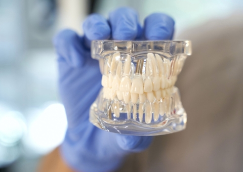 Clínica é condenada por erro em implante dentário em Manaus 
