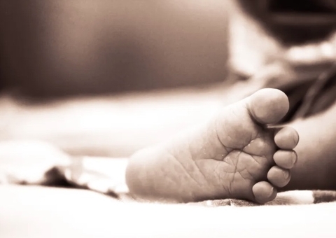 Bebê perde pênis após erro médico