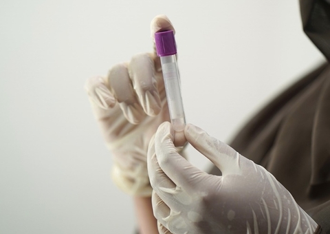 Semsa informa mudança no fluxo para realização de exames laboratoriais em Manaus