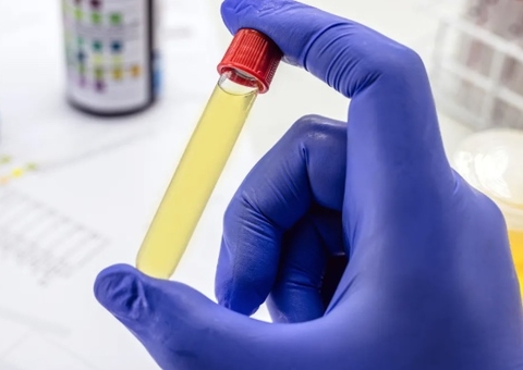 Projeto de Lei em Manaus exige exames toxicológicos para servidores e vereadores