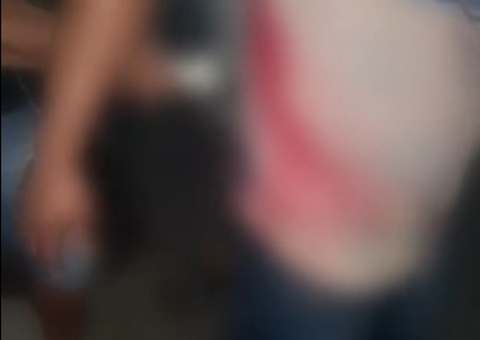 Homem caminha com facão cravado nas costas e choca população de Tefé