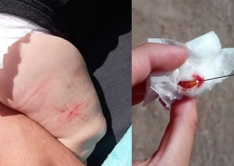 Enfermeiro esquece injeção cravada na perna de bebê após aplicação de vacinas