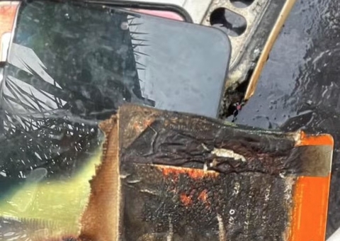 Celular explode e queima dedo de jovem enquanto dormia ao lado de aparelho em Campo Grande