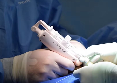 Anticoncepcional que bloqueia esperma tem previsão de lançamento em 2028