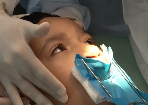 Lula sanciona lei que obriga SUS a fazer cirurgia para lábio leporino