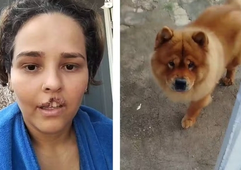 Cão é sacrificado após arrancar parte do lábio da tutora em Ji-Paraná