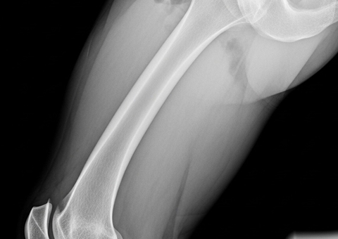 Unimed é condenada por erro médico e falha em perícia em Manaus