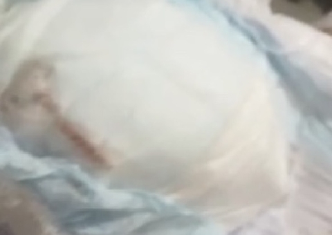 Rato é encontrado morto dentro de fralda de bebê