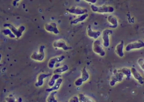 Idosa morre após contrair ameba comedora de cérebros durante lavagem nasal