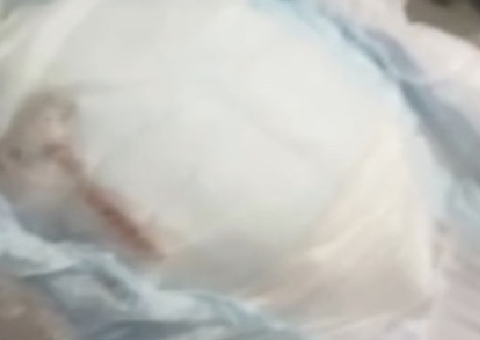 Perícia descarta rato em fralda de bebê; saiba o que era