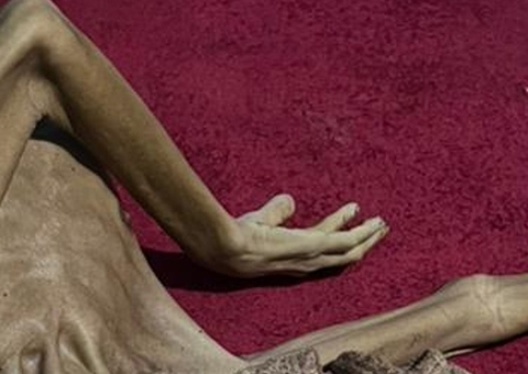 Idoso é encontrado morto em estado de desnutrição extrema no São José