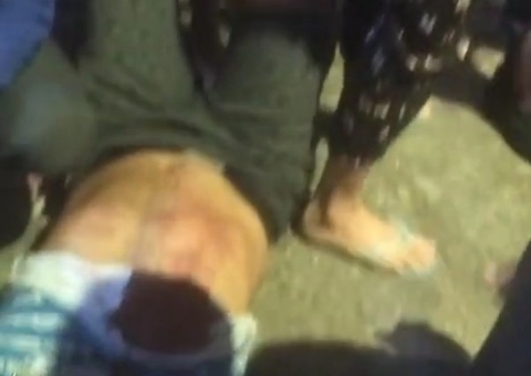 Homem é assaltado e baleado na frente de UBS no bairro da Paz