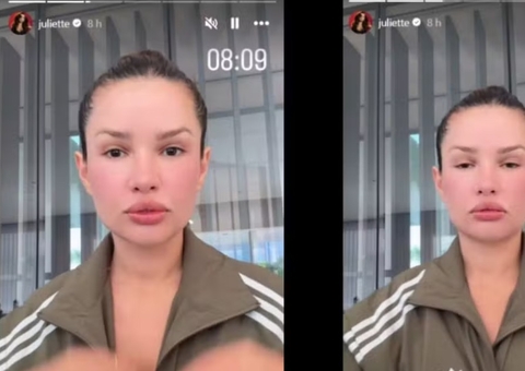 Juliette surge com rosto inchado após tratamento com ‘esperma de salmão’