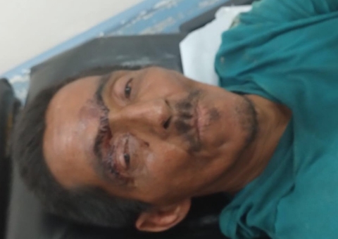 Hospital João Lúcio busca por família de paciente sem comunicação