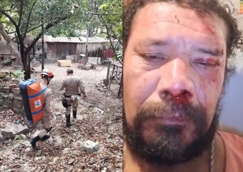 Homem é atacado por onça ao tentar defender seus cachorros