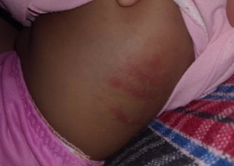 Bebê vai parar no hospital após ser espancada por padrasto em Itacoatiara