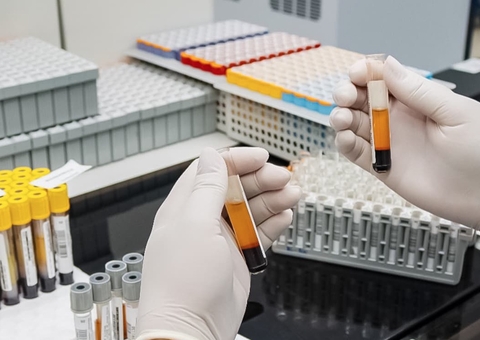 Delphina Aziz bate recorde e realiza mais de 2 milhões de exames em um ano