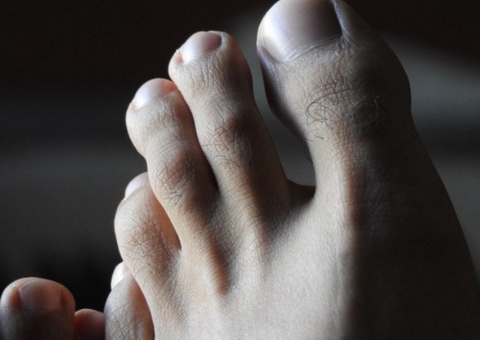 Homem morre esmagado pela companheira em acidente doméstico