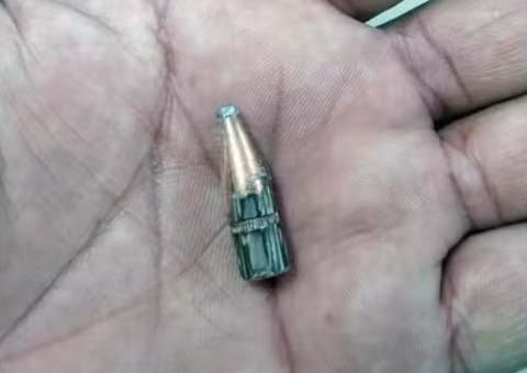 Menino de 7 anos é ferido por bala perdida: "Papai, eu não sou bandido. Por que levei um tiro?"