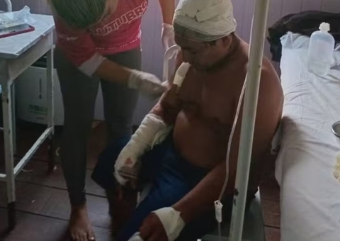 Cacique atacado por onça no Amazonas teve couro cabeludo dilacerado
