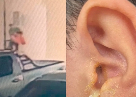 Criança que teve tímpano perfurado por servidor do TJAM sofre traumas e evita sair de casa, relata pai