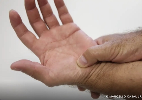 ANS torna obrigatória cobertura de medicamentos para Lúpus por planos de saúde