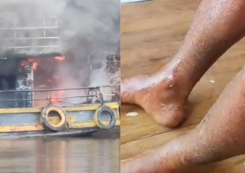 Embarcação pega fogo em Barcelos e deixa tripulante em estado grave; vídeo