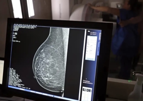 Câmara aprova projeto para garantir mamografia anual no SUS a partir dos 40 anos