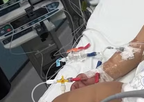 Bebê bebe soda cáustica após confundir garrafa com mamadeira e sofre queimaduras