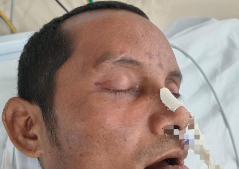 Hospital de Manaus busca identificação de paciente ferido após queda