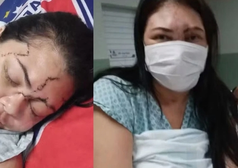 Mulher é agredida com martelo pelo ex e passa 13 dias em coma no Ceará