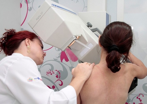 Lula sanciona lei que garante mamografia pelo SUS para mulheres a partir dos 40 anos