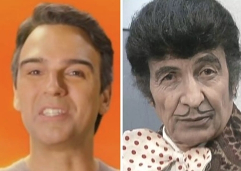 Transplante capilar de Tadeu Schmidt viraliza e fãs comparam com Zé Bonitinho