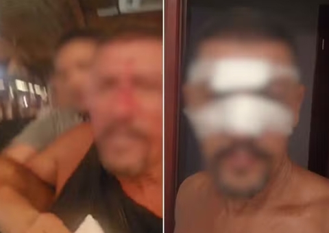 Empresário é agredido por segurança de quiosque após perder comanda em SP