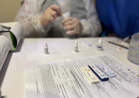 Zumbi e Lago Azul concentram as maiores taxas de ISTs em Manaus