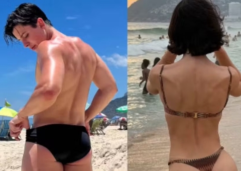 Bella Longuinho exibe antes e depois de procedimento nos glúteos; veja